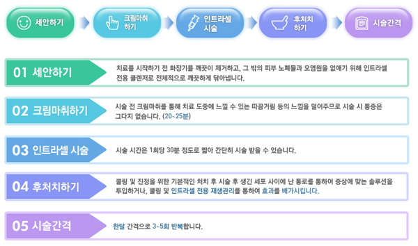 인트라셀 시술방법.jpg