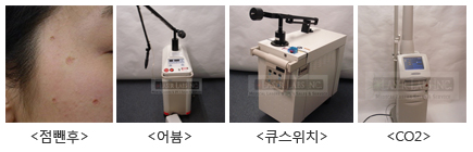 트리플점빼기_어븀_큐스위치_CO2.jpg