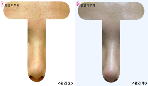 T존.jpg
