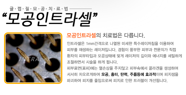 모공인트라셀_02.jpg